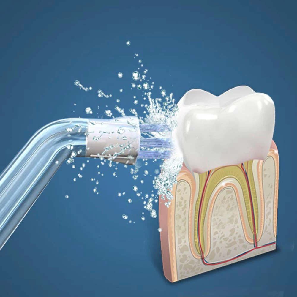 Насадка для іригатора Waterpulse YJ-300 (1 шт.)